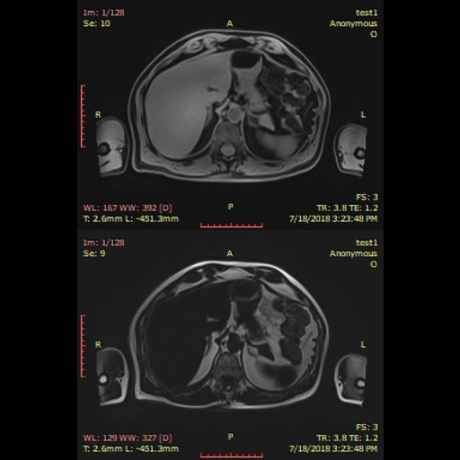 Body MRI