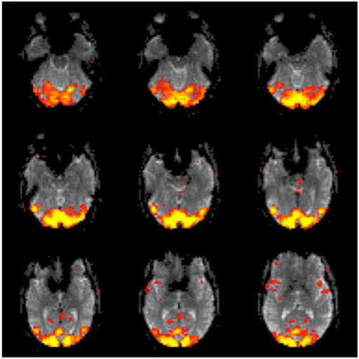 visual cortex scan